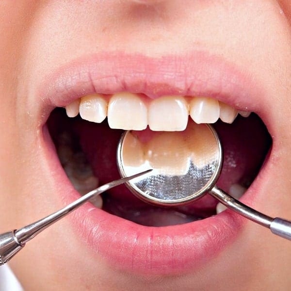 Close up of a dental mirror