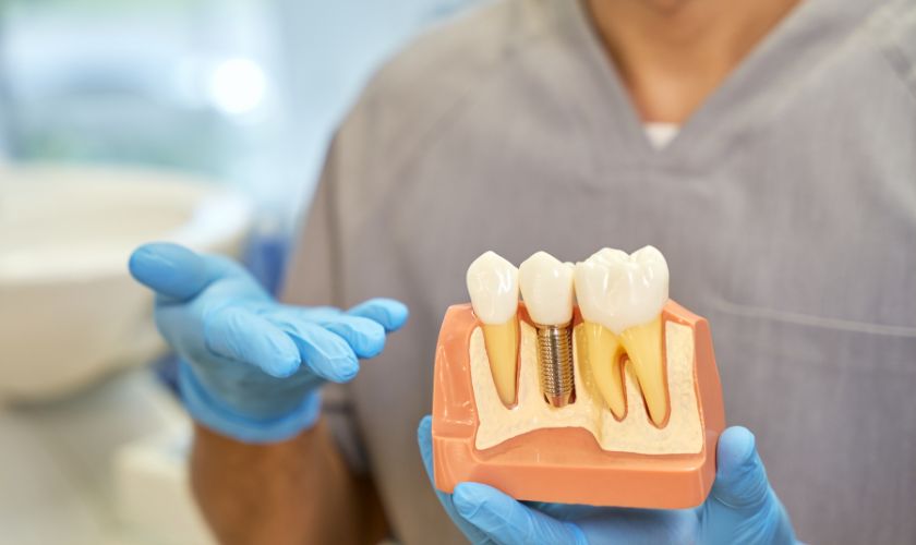 Dental Implant Surgery | BlueDot Dental Gilbert