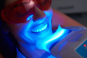 Achieve Your Dream Smile: Professional vs. At-Home Whitening
