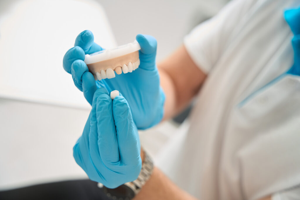 When Do You Need a Dental Crown? Key Signs