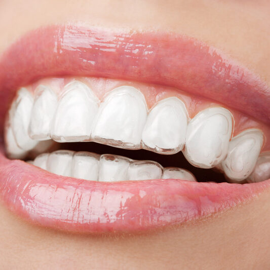 canstockphoto9221908